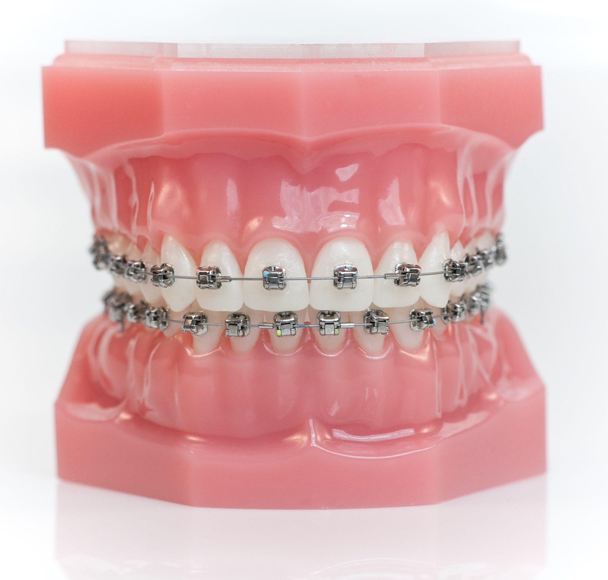 orthodontics Louisville